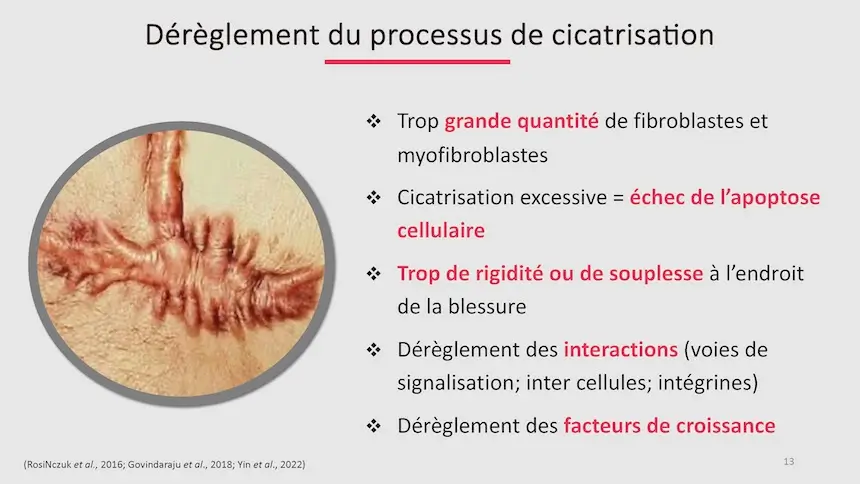 Cicatrices de césarienne | Webinaire